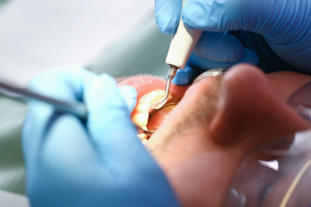 Best Affordable Emergency Dental Care  in Briarcliff, TX