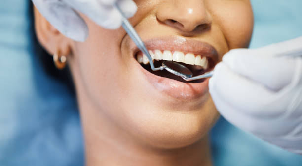 Best Chipped Tooth Repair Near Me  in Briarcliff, TX